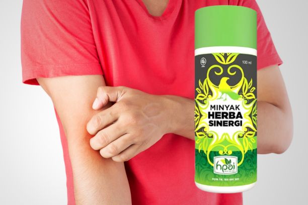 Mengatasi Gatal dengan Minyak But But Manfaat dan Cara Penggunaannya